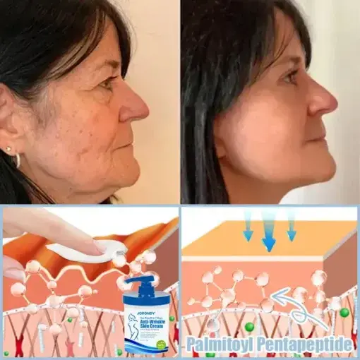 Anti-Wrinkle Skin Cream