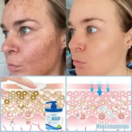 Anti-Wrinkle Skin Cream