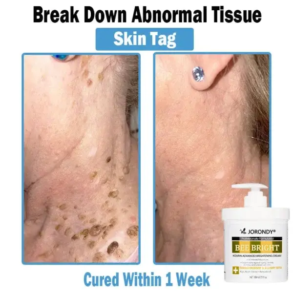 Bee Bright Multi-Symptom Skin Treatment Cream