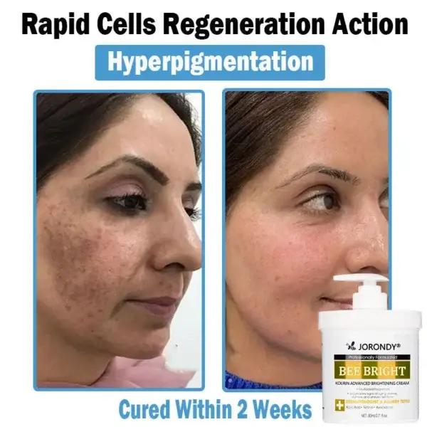 Bee Bright Multi-Symptom Skin Treatment Cream