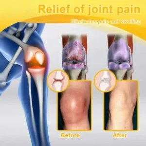 Bee Venom Pain-Relief Bone Healing Spray