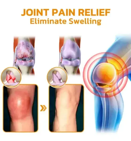 Bee Venom Pain Suppression Joint Healing Cream