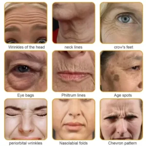 Botox Bee Venom Wrinkle Removal Cream
