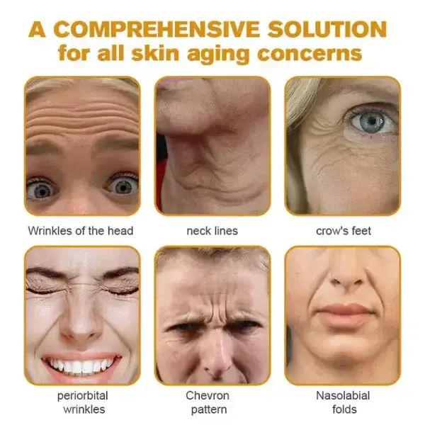 Botox Bee Venom Wrinkle Remover Cream