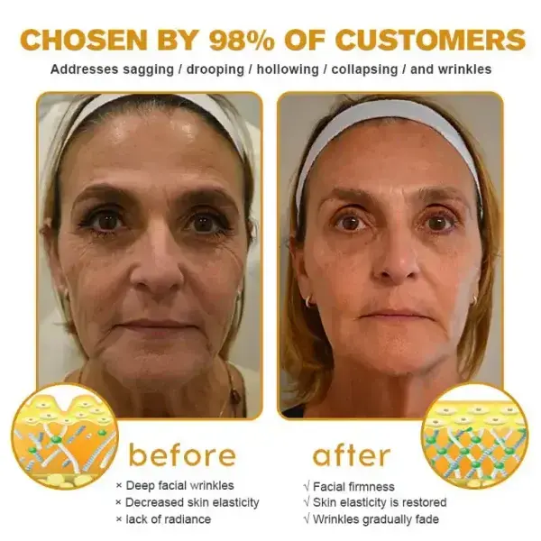 Botox Bee Venom Wrinkle Remover Cream