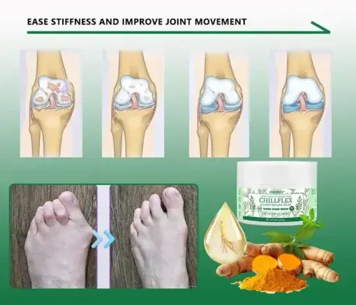 CHILLFLEX Herbal Pain Relief Cream