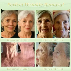 Firming Cream——Visibly Firms in Just 21 Days – Without Surgery or Irritation