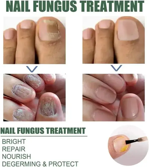Nail Repair Serum