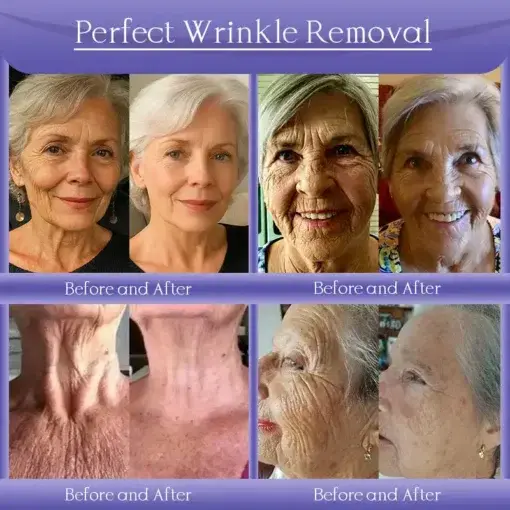 Skin Firming & Anti-Wrinkle Cream