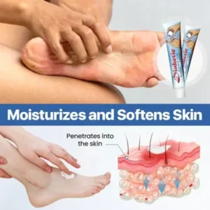 VitaGluco Diabetes Treatment Cream