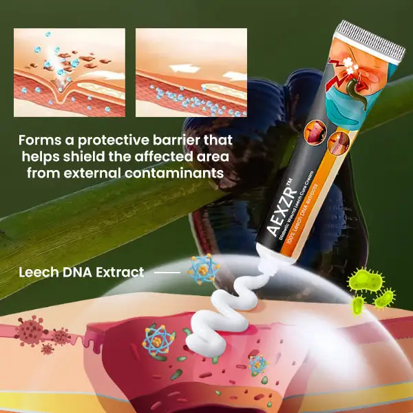Diabetic Wound Leech Cure Cream - Image 4