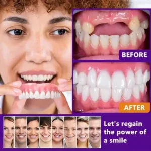 Advanced Customized Full Denture Set