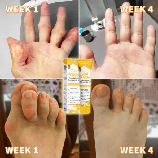 Bee Venom Joint Therapy Pain Relief Gel - Image 4
