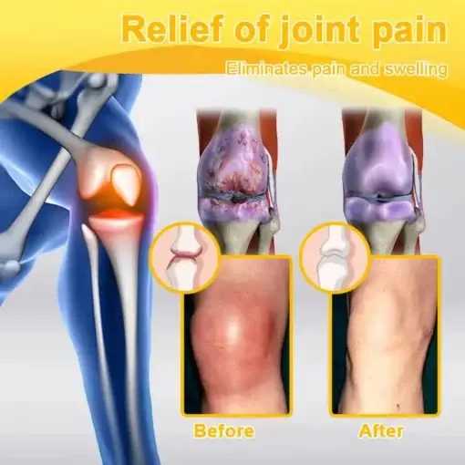 Bee-Venom Pain-Relief Bone Healing Cream - Image 10