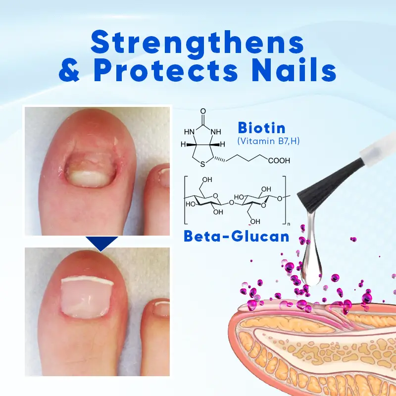 OnyxoGuard Nail Growth and Repair Serum - Image 4