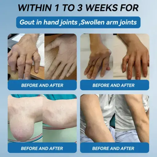 ʙ.ᴘ.ᴄ-157 Joint Healing Cream - Image 14