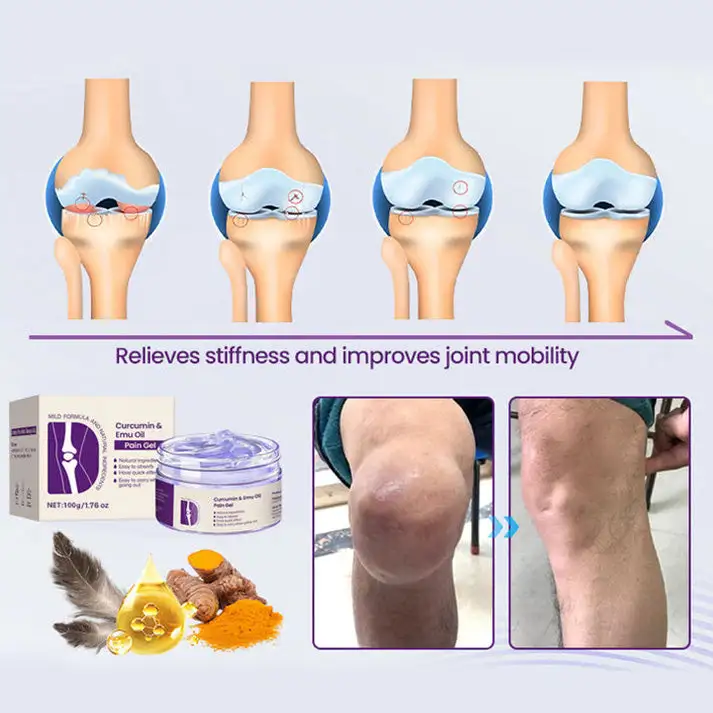 Curcumin & Emu Oil Pain Gel – 🏥Backed by US Osteopathic Experts - Image 10