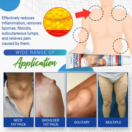 BumpClear Lipoma Removal Cream - Image 4
