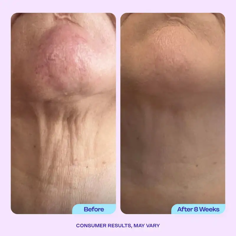 DIYSTAR Neck Cream Tighten & Lift Firming Cream - Image 7