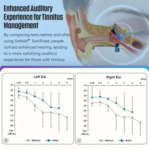 SoniPulse Tinnitus Relief Soothing Aid - Image 6