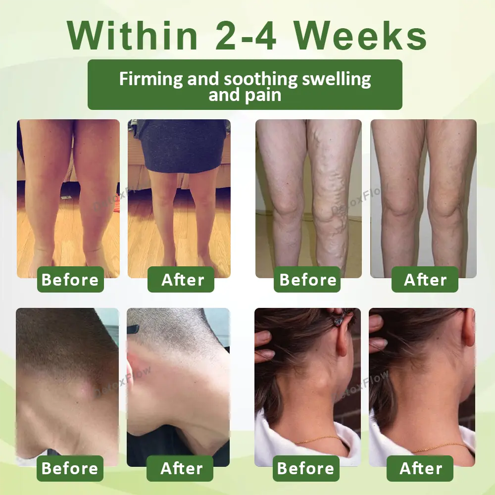 Advanced SwellCare Lymphatic Cream - Image 3