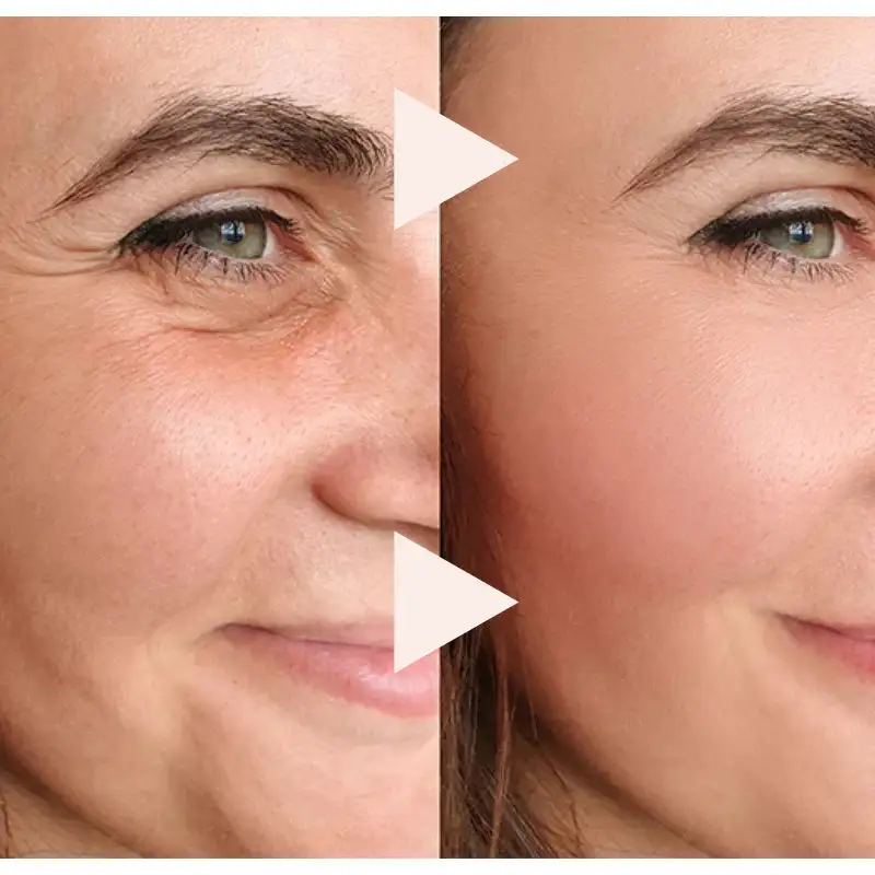 The Express Anti-Wrinkle - Image 3