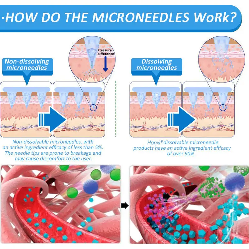 Nano Microneedle Patch - Image 3