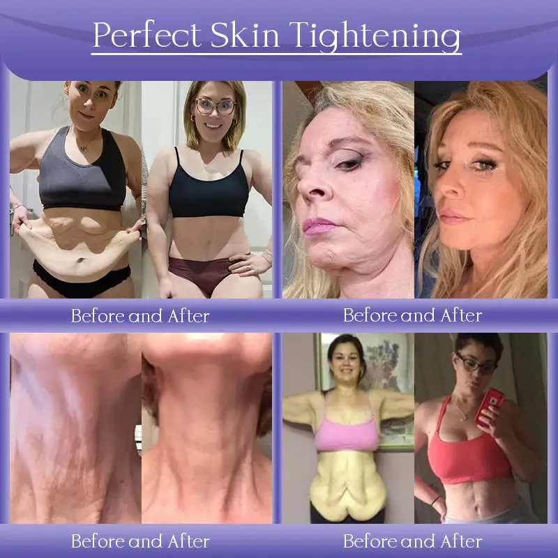 Anti-Wrinkle Skin Cream for Remove Wrinkles - Image 3