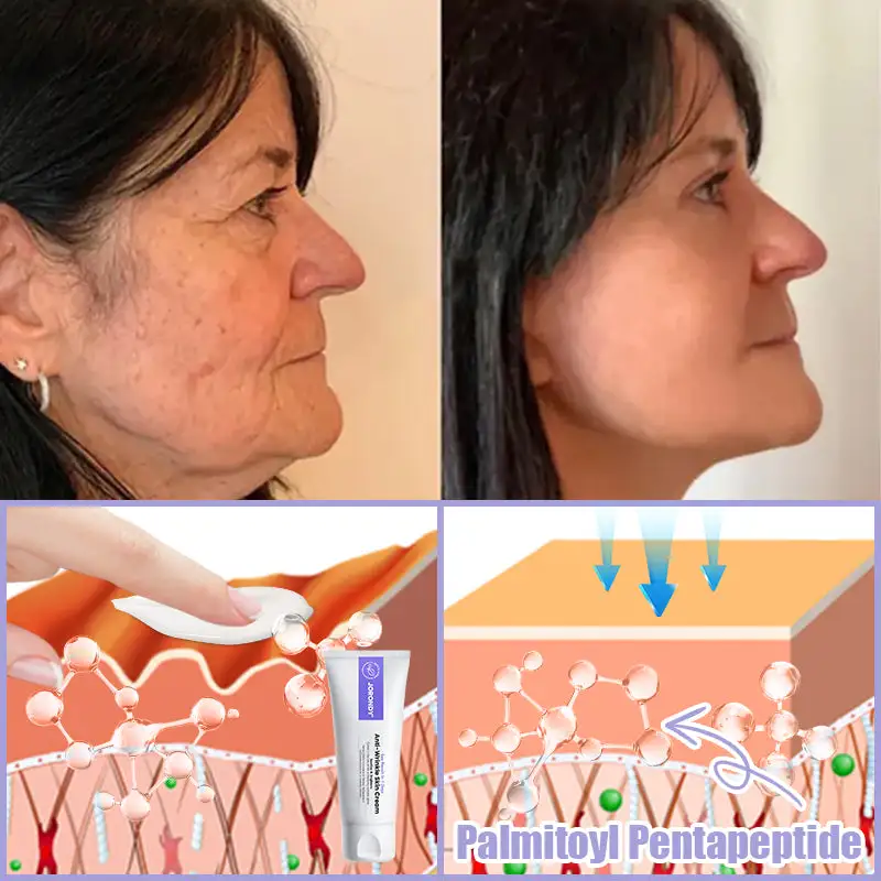 Anti-Wrinkle Skin Cream for Remove Wrinkles - Image 7