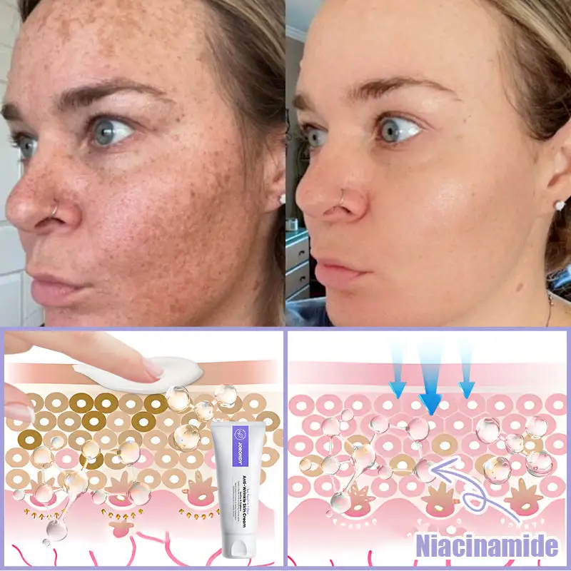 Anti-Wrinkle Skin Cream for Remove Wrinkles - Image 9