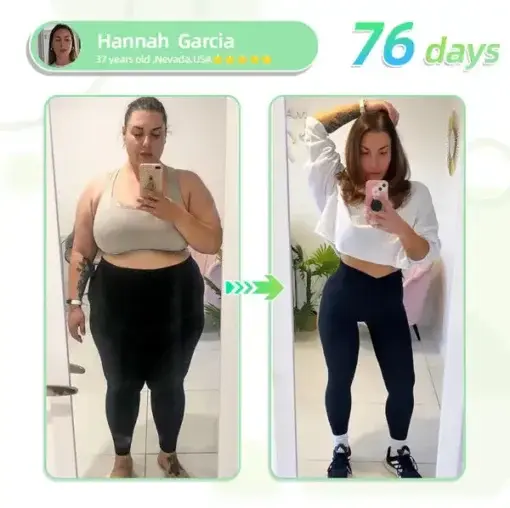 SMGT- Nano Microneedle Patch - Image 5
