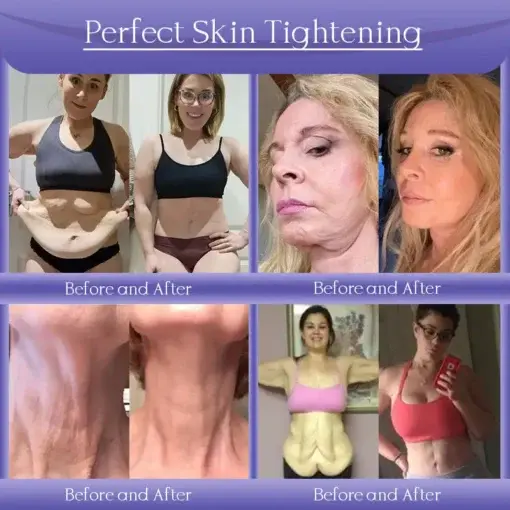 Skin Firming & Anti-Wrinkle Cream - Image 3
