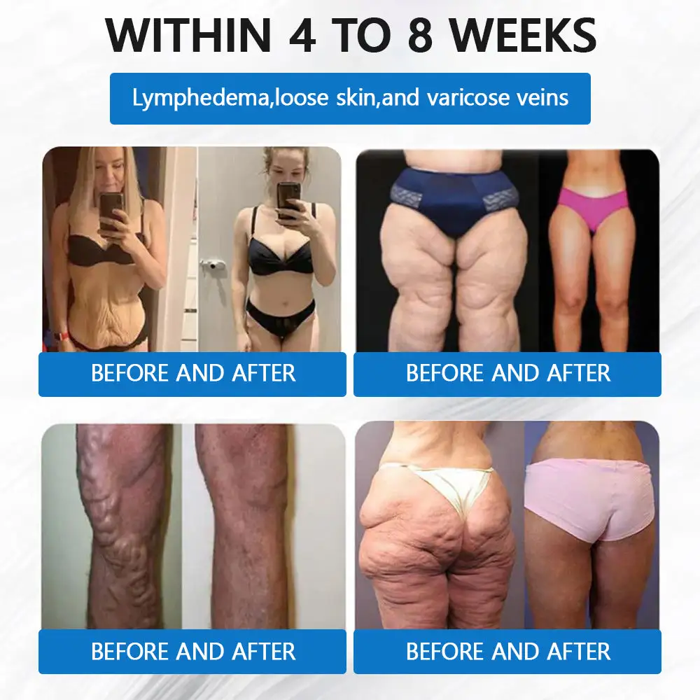 Nano Microneedle Weight Loss Patch - Image 7