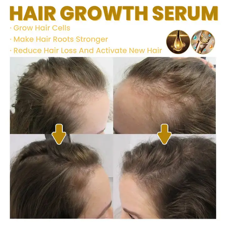 Spray-on Hair Growth Essence - Image 11