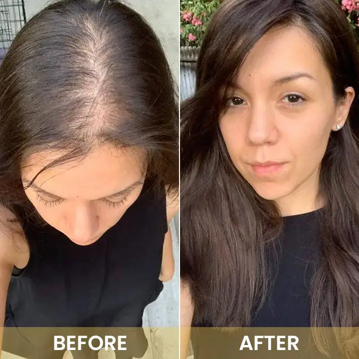 Spray-on Hair Growth Essence - Image 15