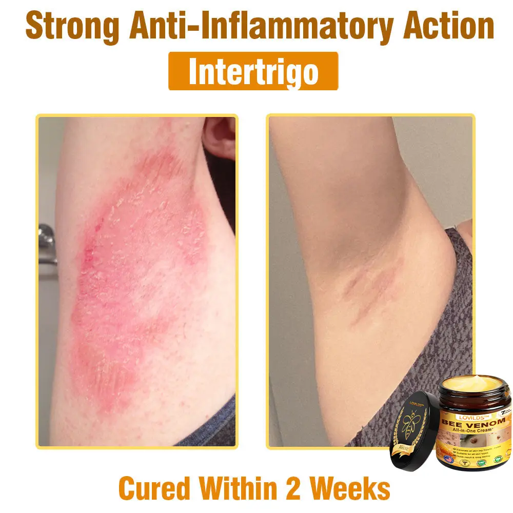 Bee Venom All-in-One Cream US Dermatologist Approved - Image 4