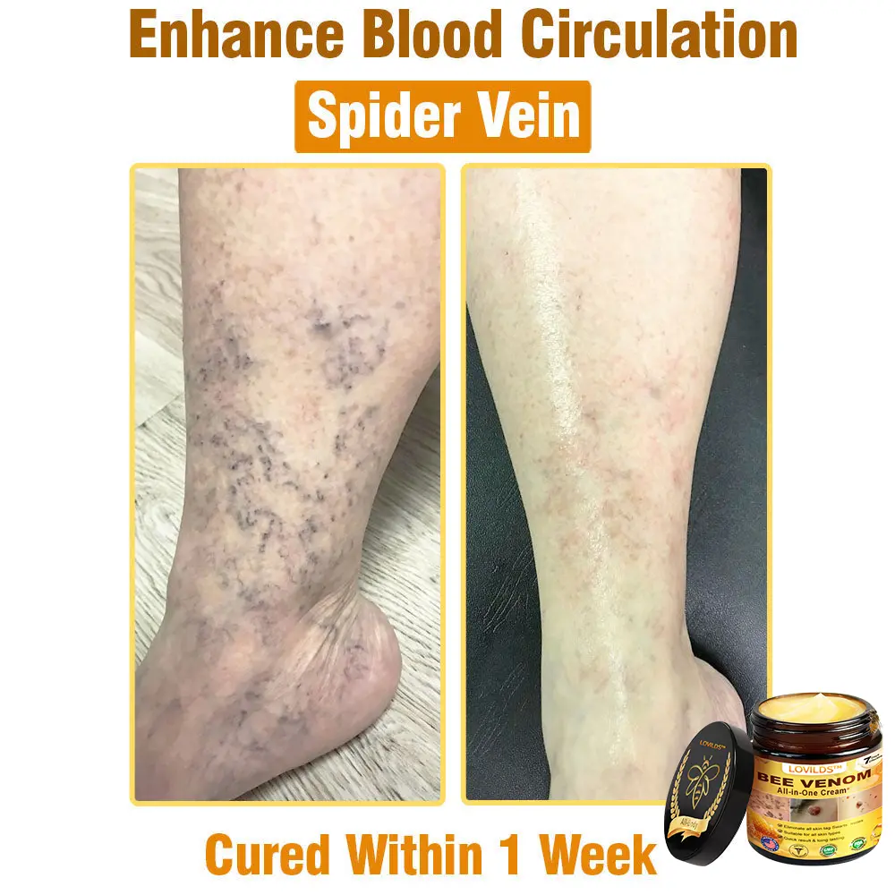 Bee Venom All-in-One Cream US Dermatologist Approved - Image 6