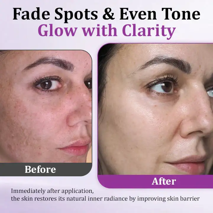 MelantraX Advanced Anti-Hyperpigmentation Essence - Image 12