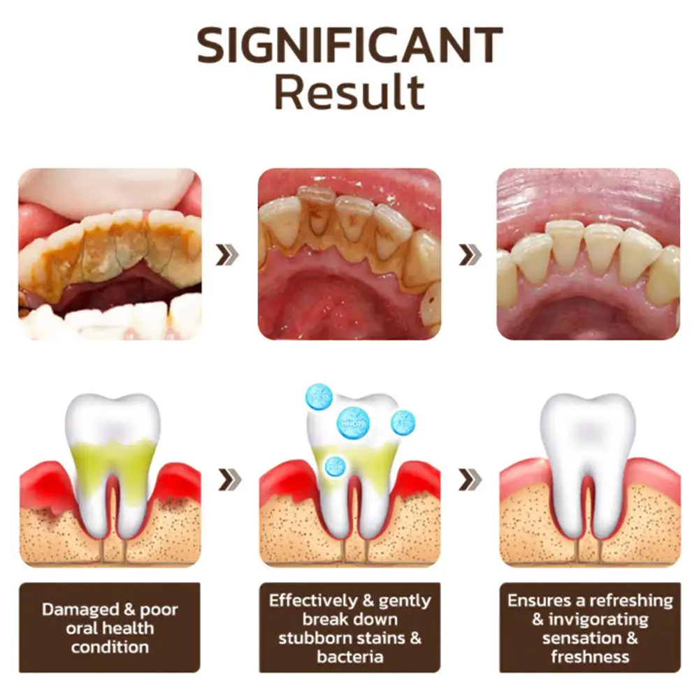 Nicotinamide Whitening Toothpaste - Image 5