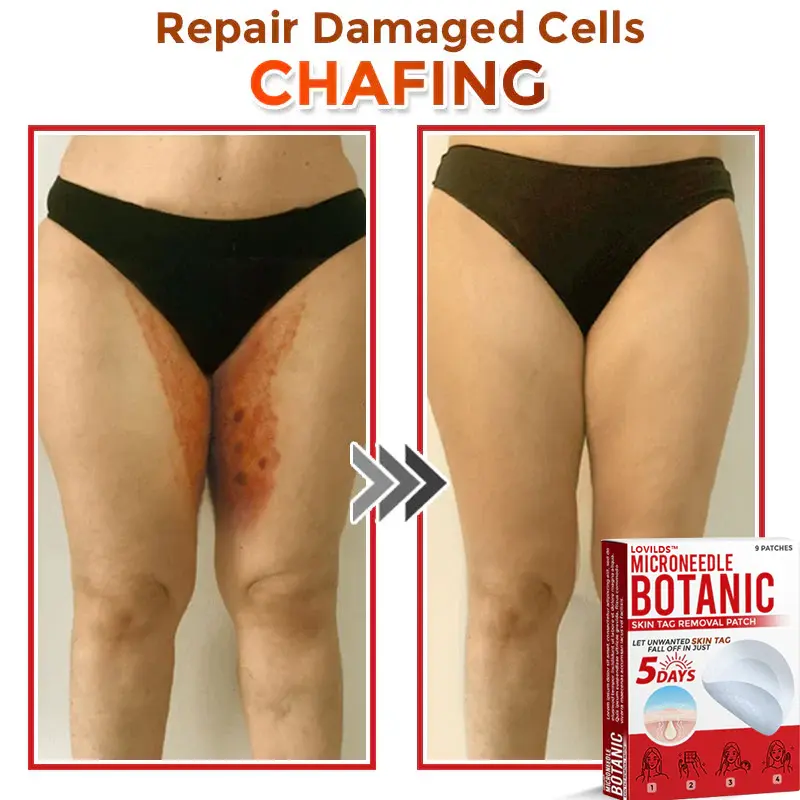 Removal Patch - Image 8