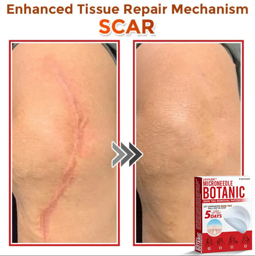 Removal Patch - Image 4
