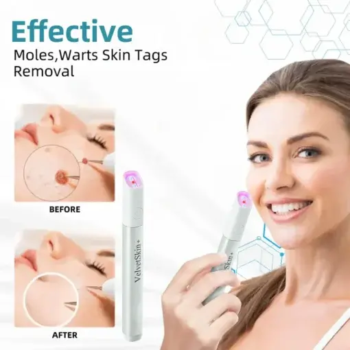 VelvetSkin+ All-in-One Laser Eraser Pen - Image 10