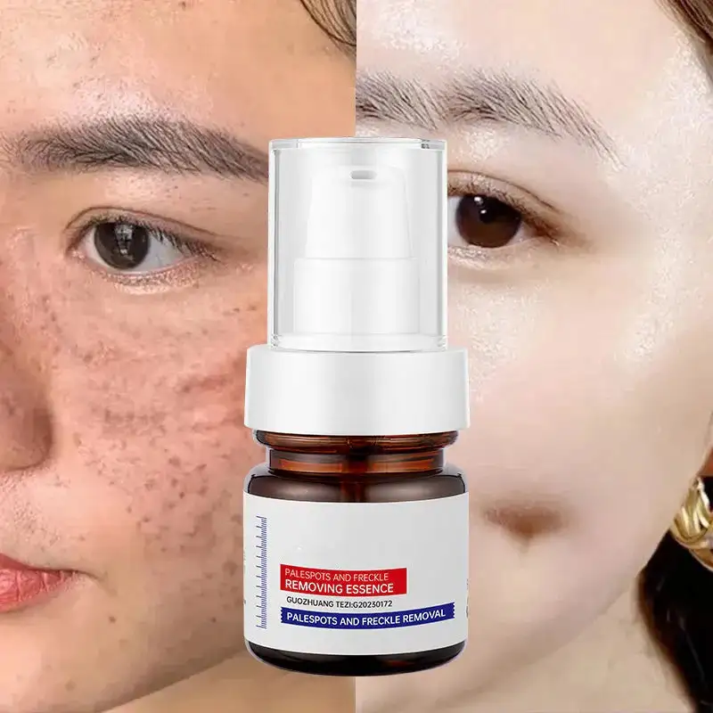 WHITENING ANDFRECKLE REMOVING ESSENCE - Image 3
