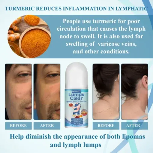 LumpsClear Lymph Say Goodbye to Lipomas and Swelling - Image 11