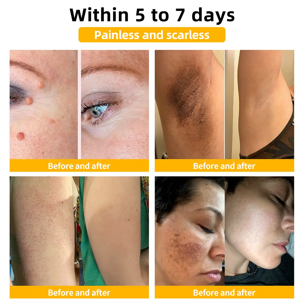Bee Venom Skin Treatment Cream - Image 3