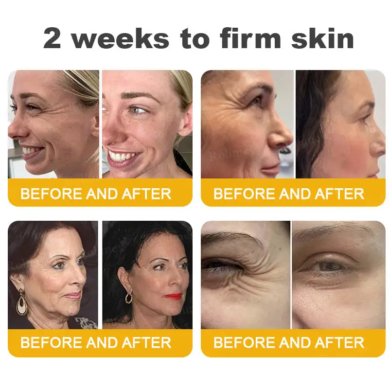 Botox Bee Venom Wrinkle Removal Cream - Image 9