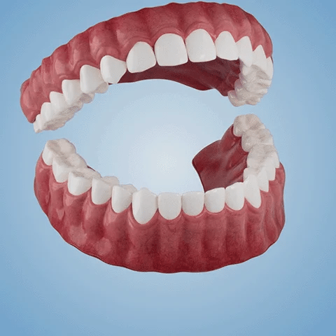Advanced Customized Full Denture Set - Image 6