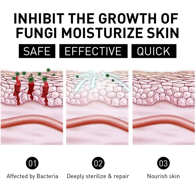 Psoriasis Cure Cream - Image 6