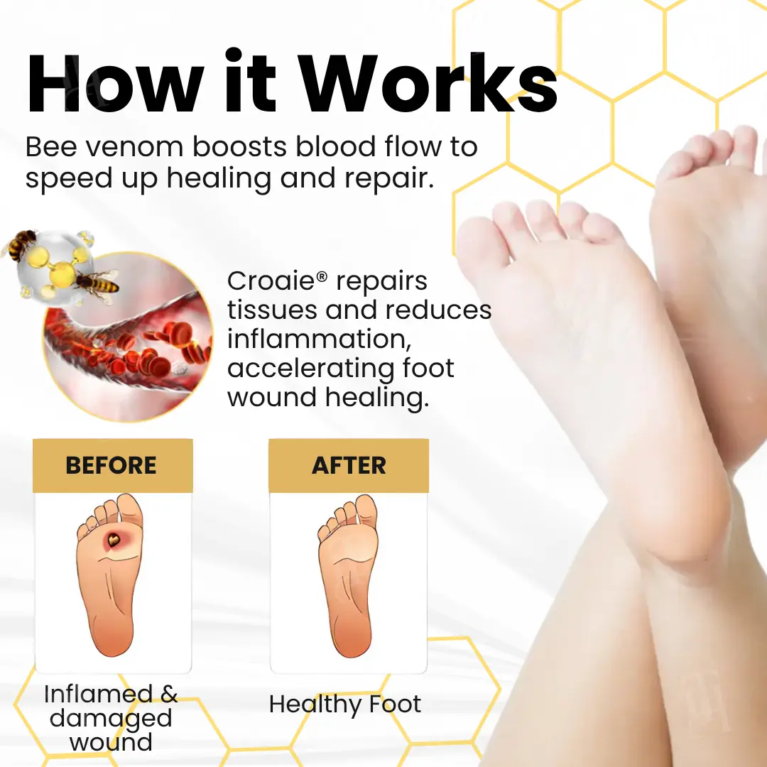 Bee Venom Diabetic Foot Ulcer Spray - Image 4