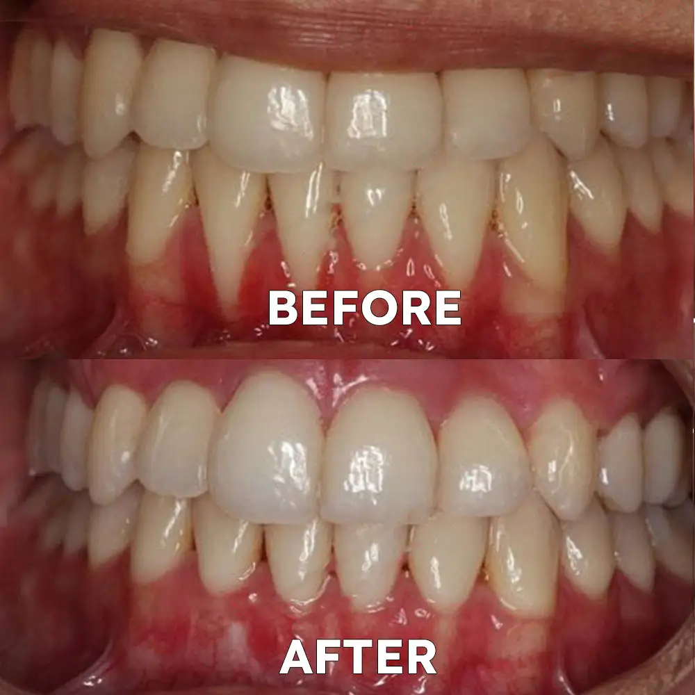 Tooth Health Mineral Powder - Image 3